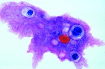 Mikropräparat - Amoeba proteus, Wechseltierchen, total