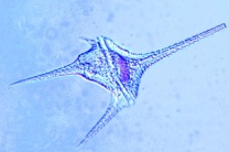 Mikropräparat - Ceratium hirundinella, Dinoflagellat aus dem Süßwasser, total