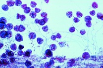 Mikropräparat - Vorticella, Glockentierchen