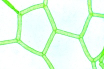 Mikropräparat - Hydrodiction, Wassernetzalge