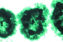 Mikropräparat - Rotalge, Batrachospermum, Froschlaichalge