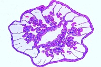 Mikropräparat - Hydractinia, Hydroidpolyp
