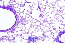 Mikropräparat - Lunge vom Rind, quer