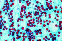 Mikropräparat - Aleuronkörner im Endosperm der Rizinusbohne (Ricinus), quer