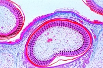 Mikropräparat - Huhn, Federentwicklung: zwei Flügelanlagen verschiedenen Alters, quer Mikropräparat - Huhn, Federentwicklung: zwei Flügelanlagen verschiedenen Alters, quer