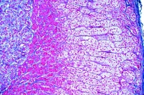 Mikropräparat - Nebenniere (Gl. suprarenalis), Mensch, quer Mikropräparat - Nebenniere (Gl. suprarenalis), Mensch, quer