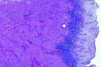 Mikropräparat - Gebärmutter (Uterus), Mensch, quer Mikropräparat - Gebärmutter (Uterus), Mensch, quer