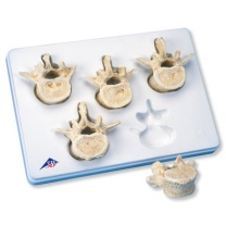 Set mit 5 Lendenwirbeln Set mit 5 Lendenwirbeln