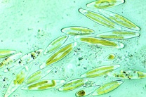 Mikropräparat - Süßwasserdiatomeen , Färbung der Chromatophoren