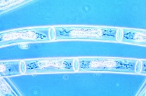 Mikropräparat - Mougeotia, plattenförmige Chloroplasten