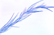 Mikropräparat - Chaetophora, stark verzweigter Thallus