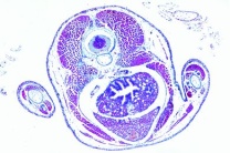 Mikropräparat - Salamander-Larve, Brustregion und Vorderbeine, quer Mikropräparat - Salamander-Larve, Brustregion und Vorderbeine, quer