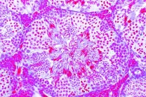 Mikropräparat - Salamandra, Hoden quer. Demonstrationsobjekt für Zellteilungen (Mitosen)