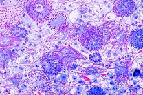 Mikropräparat - Lumbricus, Spermatozoen, Ausstrich