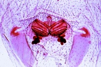 Mikropräparat - Spinne, Epigyne des Weibchens, total *