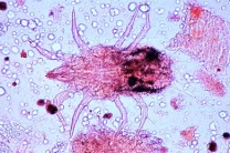 Mikropräparat - Tyroglyphus farinae, Mehlmilben