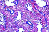 Mikropräparat - Gallus, Lunge quer. Lungenpfeifen