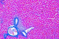 Mikropräparat - Gallus, Leber quer Mikropräparat - Gallus, Leber quer