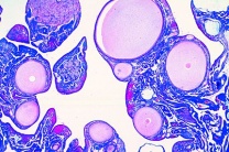Mikropräparat - Gallus, Eierstock quer, Eientwicklung