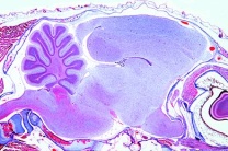 Mikropräparat - Gallus, Großhirn quer