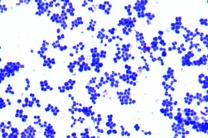 Mikropräparat - Sarcina lutea. Paketkokken. Ausstrich von Kultur Mikropräparat - Sarcina lutea. Paketkokken. Ausstrich von Kultur