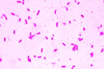 Mikropräparat - Acetobacter aceti. Essigbakterien. Ausstrich