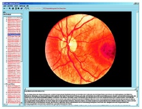 Die Sinnesorgane als Tor zur Umwelt, Interaktive CD-ROM