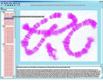 Zellteilung und Reifeteilung (Mitose und Meiose), Interaktive CD-ROM