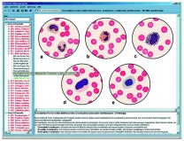 Vererbung und Genetik des Menschen Teil II, Interaktive CD-ROM