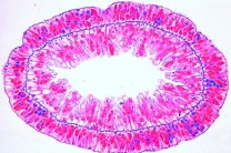 Mikropräparat - Hydra, Querschnitte durch verschiedene Körperregionen. Ektoderm mit Nesselzellen, Stützlamelle und Entoderm