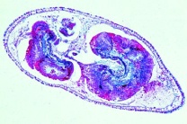 Mikropräparat - Hydra mit Nahrung, Querschnitt
