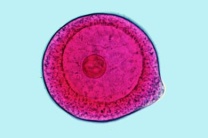 Mikropräparat - Psammechinus miliaris, Seeigel-Embryologie, unbefruchtete Eier Mikropräparat - Psammechinus miliaris, Seeigel-Embryologie, unbefruchtete Eier