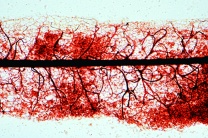 Mikropräparat - Stemonitis, Schleimpilz, Capillitium mit Sporen, total