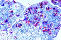 Mikropräparat - Synchytrium endobioticum, Kartoffelkrebs, quer