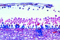 Mikropräparat - Albugo candida (Cystopus), Weißer Rost der Kruziferen, Konidienbildung auf Capsella, quer