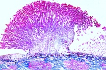 Mikropräparat - Sclerotinia fructigena (Monilia albicans), Kernobstfäule, erkrankte Frucht mit Konidienbildung, quer Mikropräparat - Sclerotinia fructigena (Monilia albicans), Kernobstfäule, erkrankte Frucht mit Konidienbildung, quer