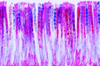 Mikropräparat - Morchella edulis, Morchel, Fruchtkörper mit Asci und Sporen, quer