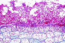 Mikropräparat - Botrytis allii, Grauschimmelfäule der Küchenzwiebel, quer Mikropräparat - Botrytis allii, Grauschimmelfäule der Küchenzwiebel, quer