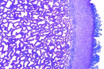 Mikropräparat - Scleroderma vulgare, Kartoffelbovist, junger Fruchtkörper quer