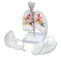 CT-Bronchialbaum mit Kehlkopf