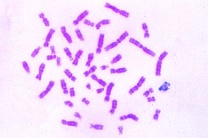 Mikropräparat - Chromosomen des Menschen aus Leukozytenkultur, männlich