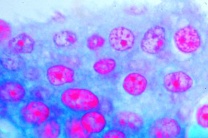 Mikropräparat - Mesothel, Schnitt durch das Mesenterium