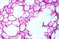 Mikropräparat - Lunge quer. Färbung der elastischen Substanz