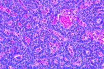 Mikropräparat - Nebenschilddrüse (Gl. parathyreoidea, quer