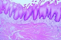 Mikropräparat - Zunge vom Menschen, quer Mikropräparat - Zunge vom Menschen, quer