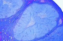 Mikropräparat - Eierstock, Gelbkörper (Corpus albicans), quer