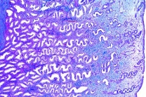 Mikropräparat - Uterus vom Mensch, quer, Übersicht