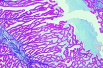 Mikropräparat - Samenblasendrüse (Gl. vesiculosa), quer Mikropräparat - Samenblasendrüse (Gl. vesiculosa), quer