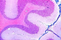 Mikropräparat - Kleinhirn quer. Übersichtsfärbung