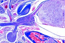 Mikropräparat - Sympathisches Ganglion quer, Übersichtsfärbung